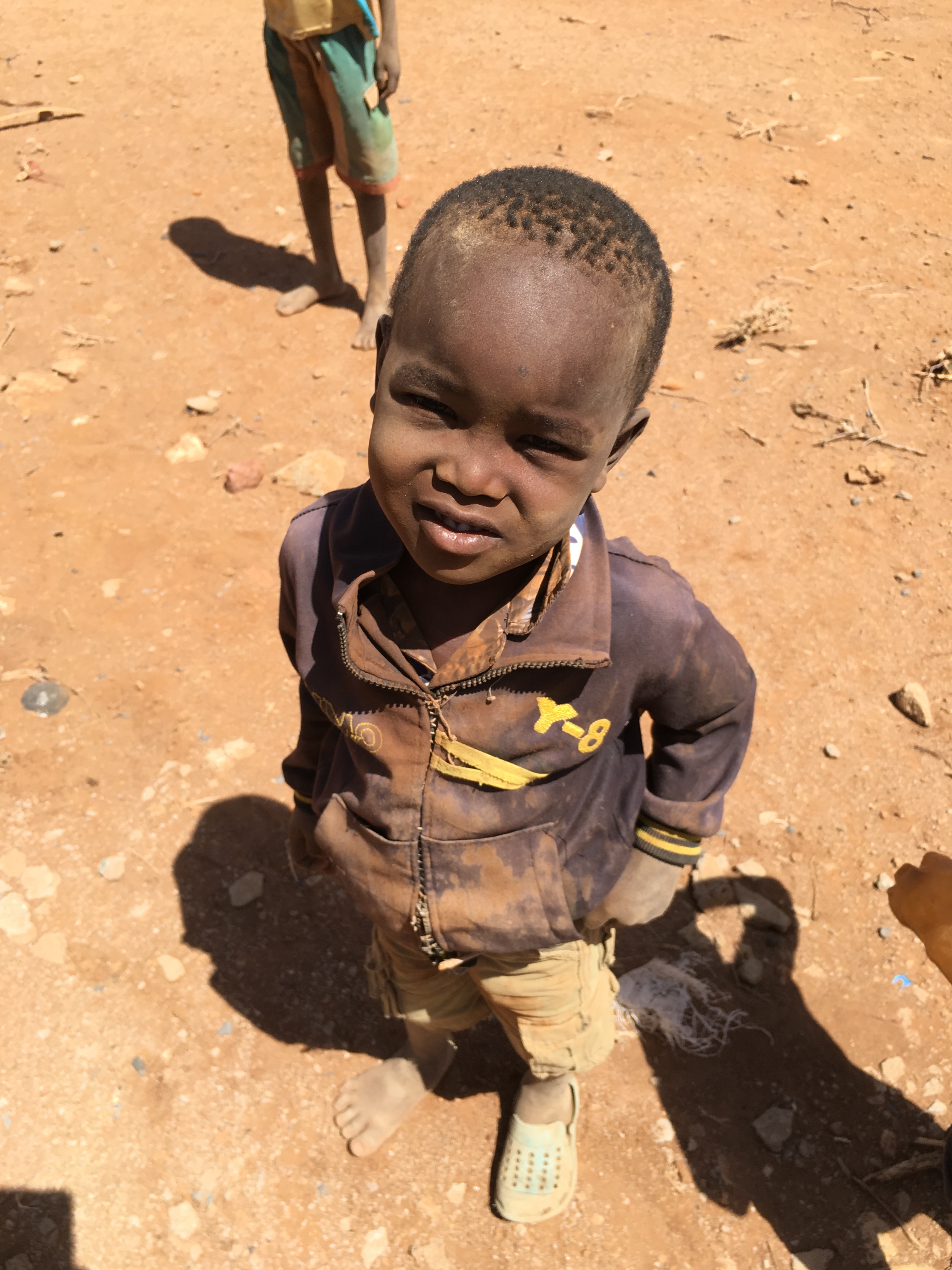 Refugee child in Africa